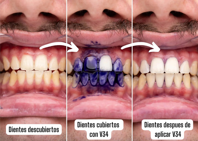 Blanqueador Dental v34 - HiSmile Original